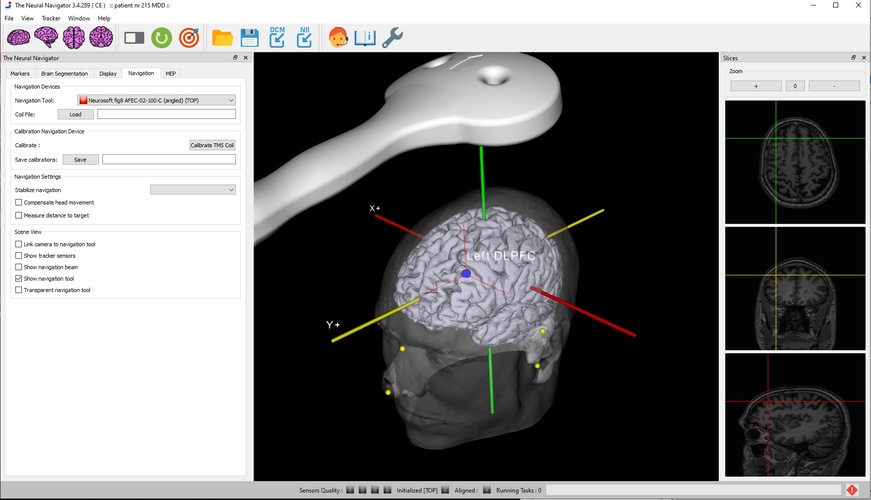Neural Navigator Essentials variant
