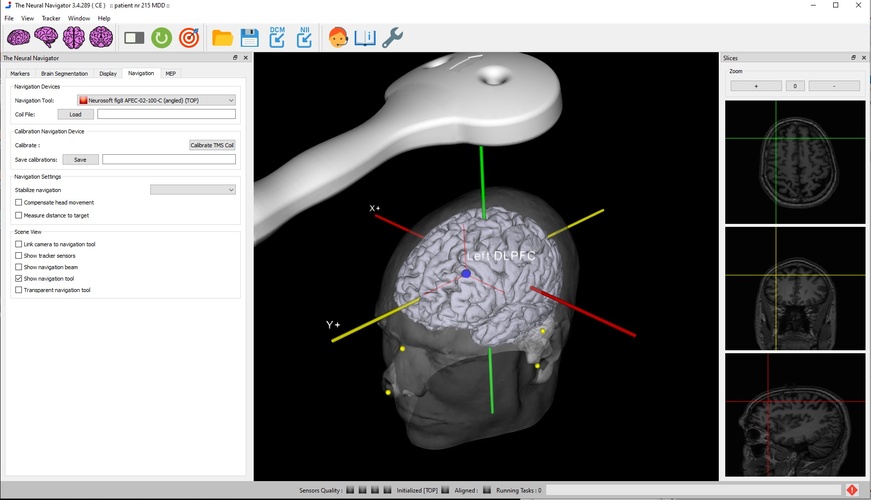 Neural Navigator Essentials Variante