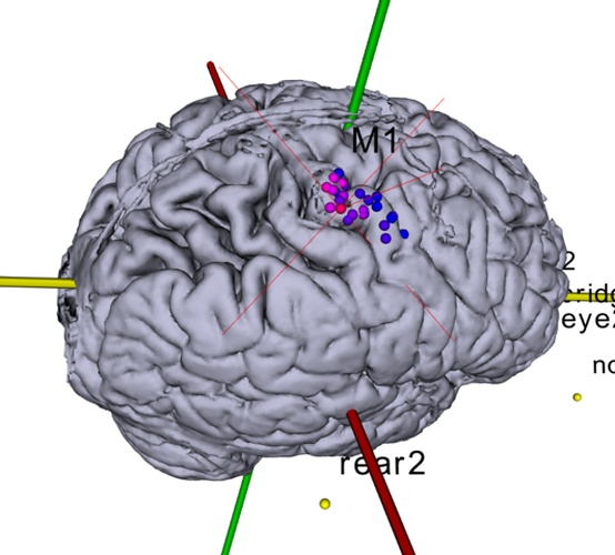 Neural Navigator MotorMap Variante