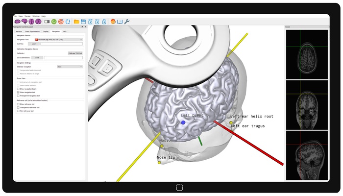 Neuronavigation for TMS