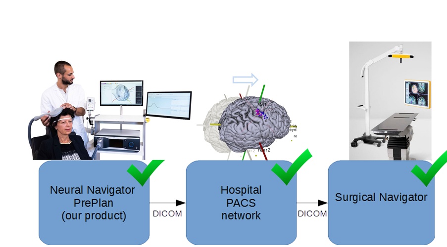 Komplettlösung für die neurochirurgische Planung