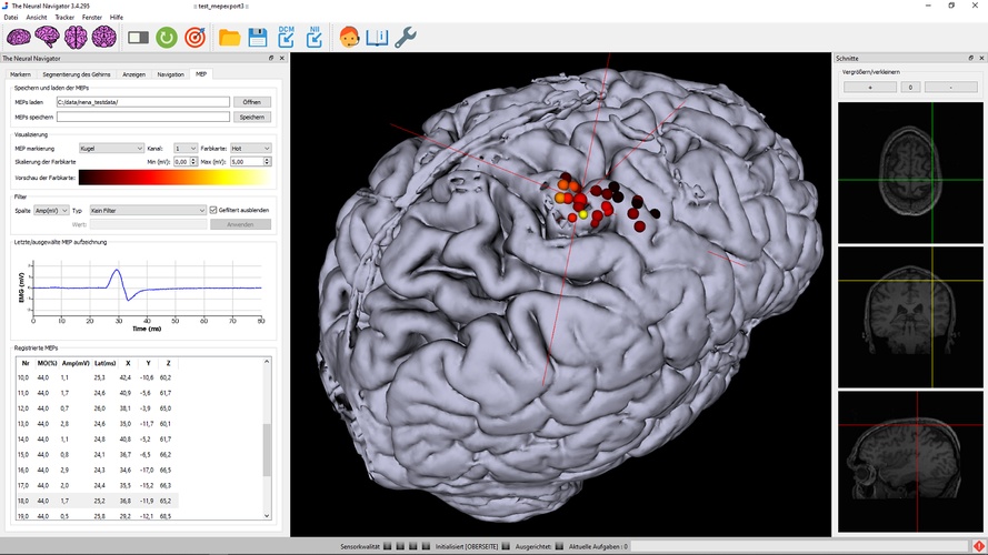 Neural Navigator MotorMap Variante