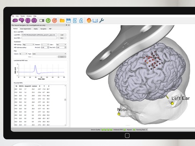 TMS motor mapping