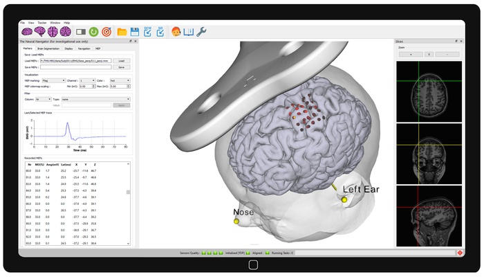 TMS motor mapping