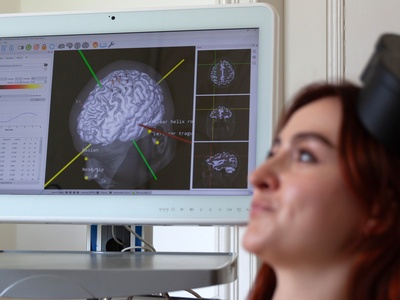 Navigated rTMS treatment