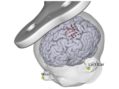 Neural Navigator MotorMap Variante